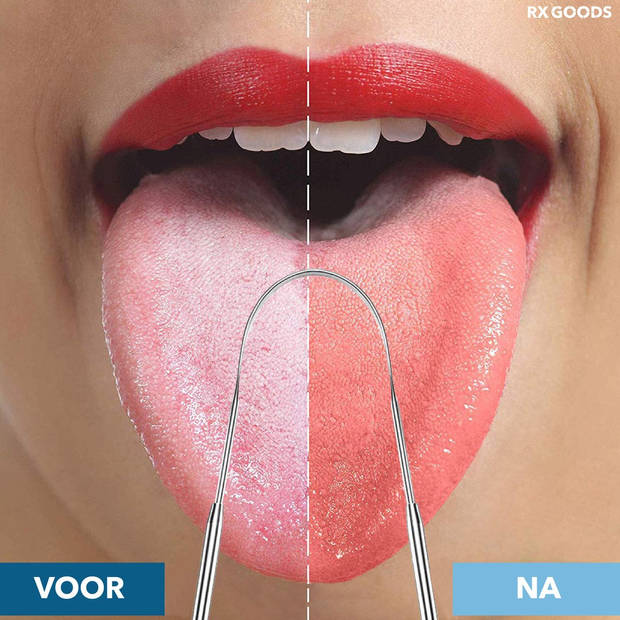Tongschraper - 3 delig | Nooit meer een vieze adem (1+1 GRATIS)