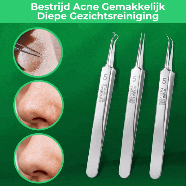 SkinPro Toolkit™ - 3 precisie pincetten voor een zuivere en stralende huid