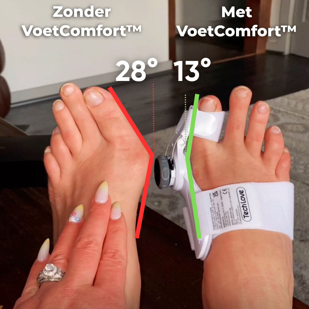 VoetComfortCorrector™ | Voor de perfecte voeten