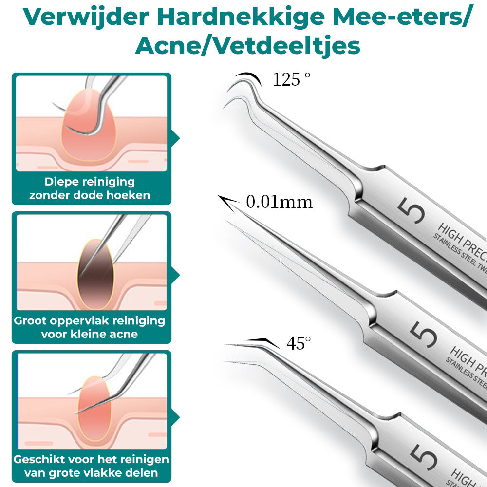 SkinPro Toolkit™ - 3 precisie pincetten voor een zuivere en stralende huid