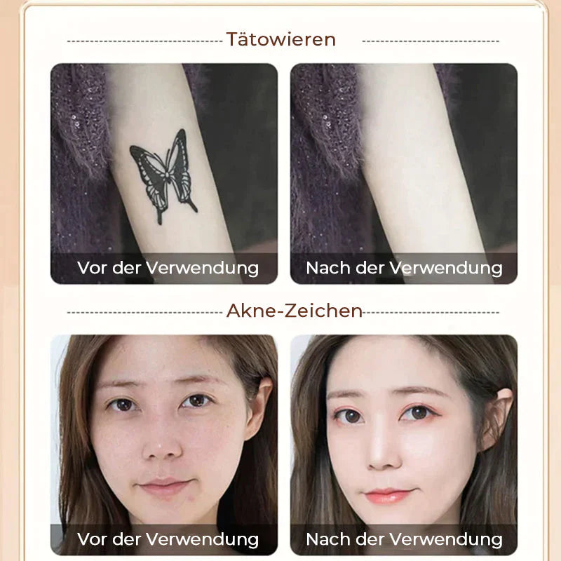 UltimateSkin™ - Voor een puntgave huid en meer zelfvertrouwen! 1+1 gratis vandaag!