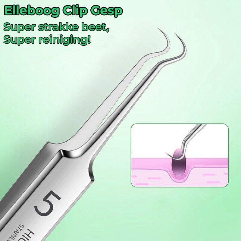 SkinPro Toolkit™ - 3 precisie pincetten voor een zuivere en stralende huid