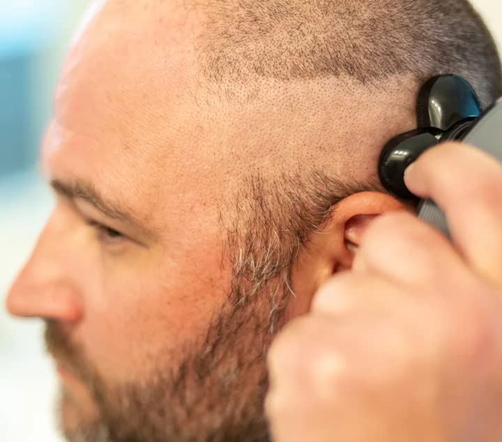 ShavePro™ - Scheren en trimmen zonder wondjes!