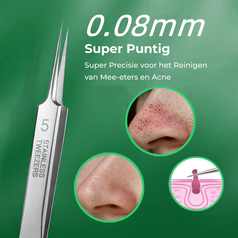 SkinPro Toolkit™ - 3 precisie pincetten voor een zuivere en stralende huid