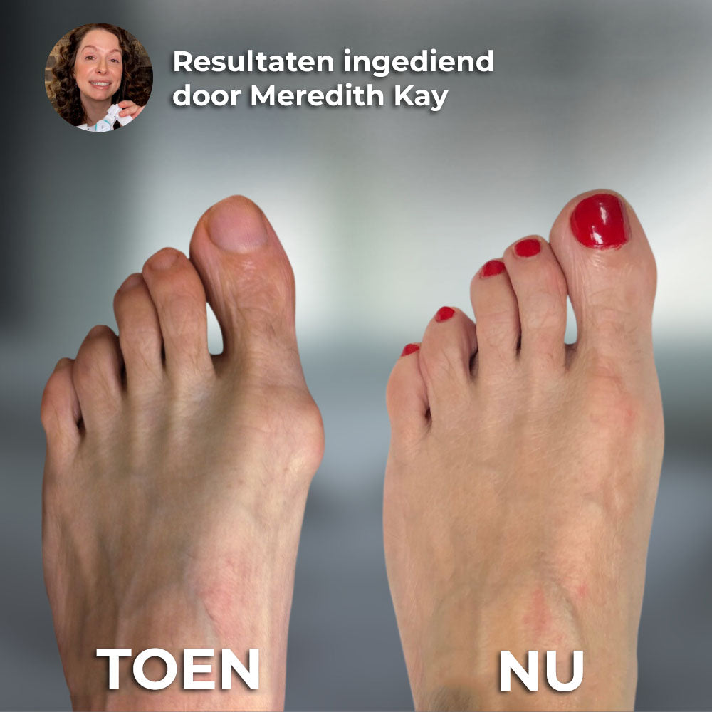 VoetComfortCorrector™ | Voor de perfecte voeten