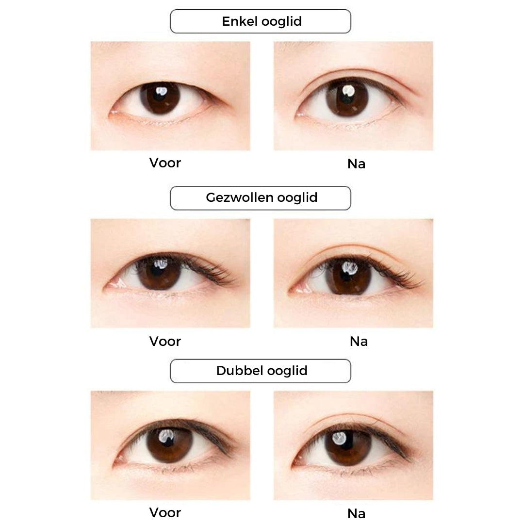 EyeLifter™ - strakke oogleden zonder dure operatie