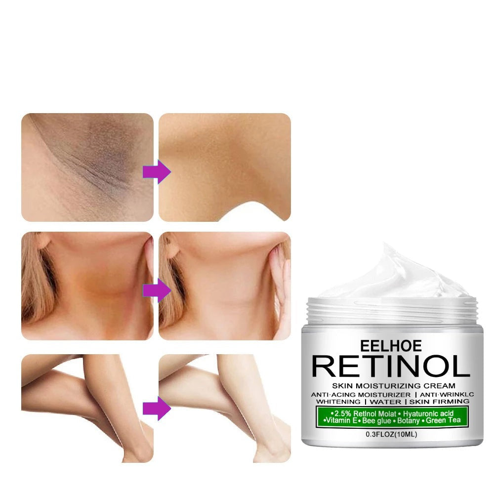 (1+1 Gratis) rWhite® | Retinol Blekende Crème