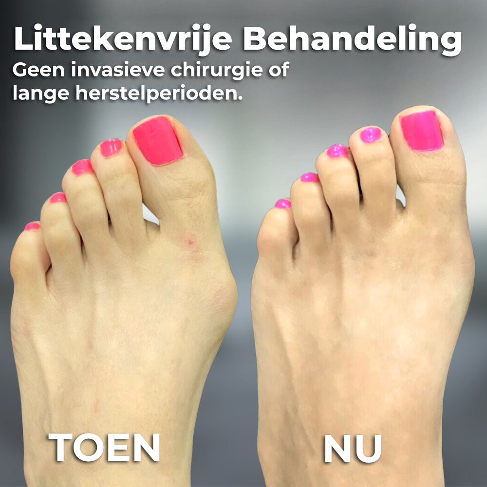 VoetComfortCorrector™ | Voor de perfecte voeten