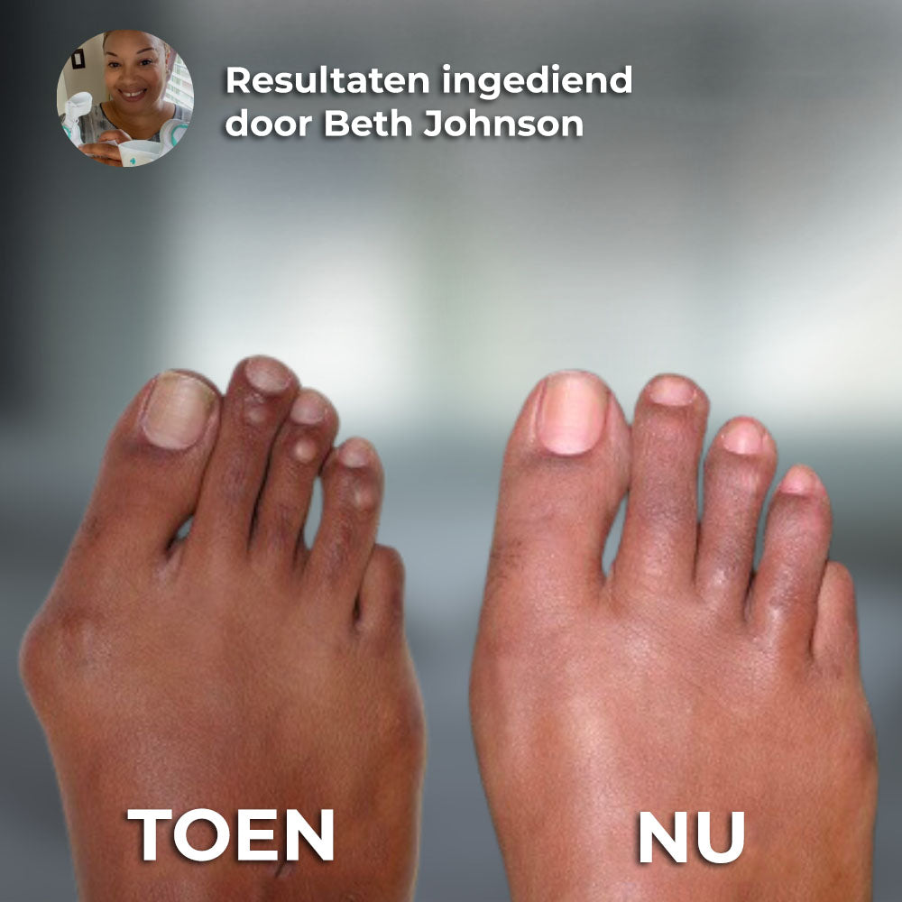 VoetComfortCorrector™ | Voor de perfecte voeten